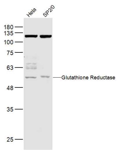 Anti-Glutathione Reductase antibody (bs-0837R)